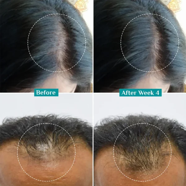 3% Redensyl + 4% Anagain Hair Growth Serum – Clinically Proven for Thicker, Fuller Hair in 28 Days | Reduces Hair Loss & Boosts Regrowth - Image 6