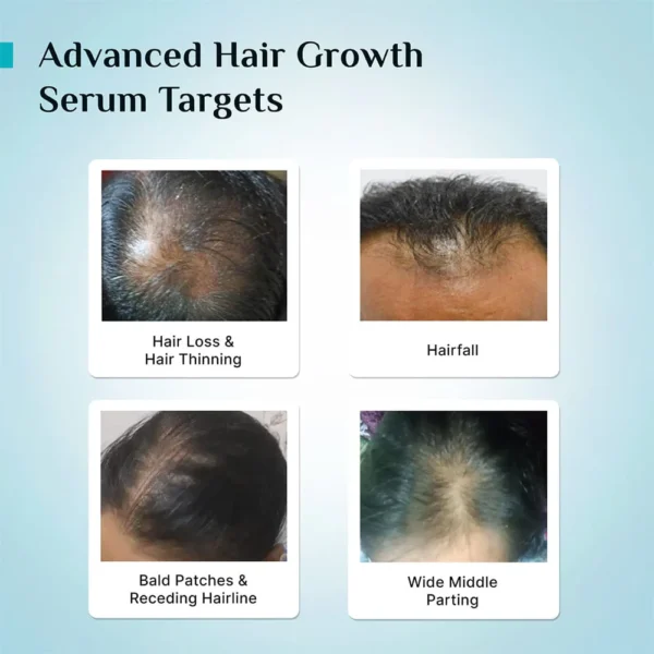 3% Redensyl + 4% Anagain Hair Growth Serum – Clinically Proven for Thicker, Fuller Hair in 28 Days | Reduces Hair Loss & Boosts Regrowth - Image 7