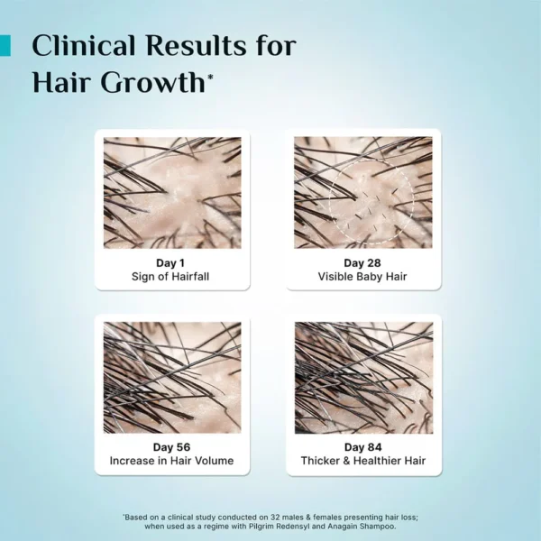 3% Redensyl + 4% Anagain Hair Growth Serum – Clinically Proven for Thicker, Fuller Hair in 28 Days | Reduces Hair Loss & Boosts Regrowth - Image 8