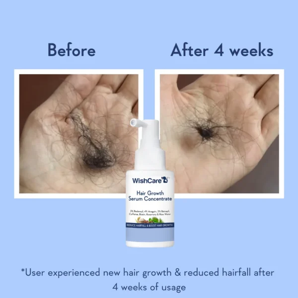 Hair Growth Serum Concentrate – Reduces Hair Fall, Boosts New Growth & Increases Hair Density | Lightweight & No Side Effects - Image 4